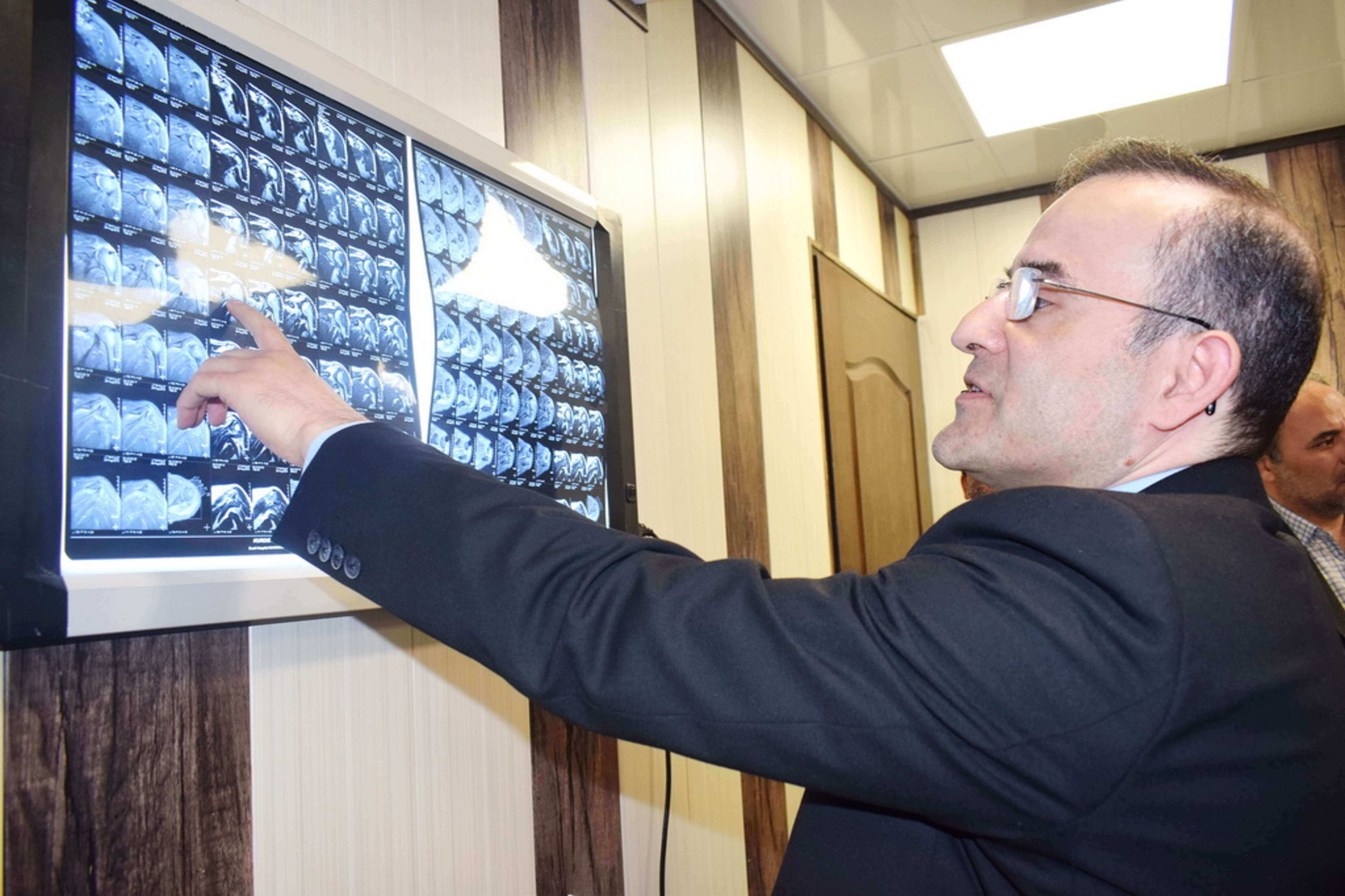 استئومیلیت6