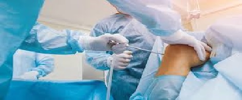 آرتروسکوپی