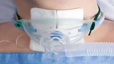 مراقبت از تراکیاستومی