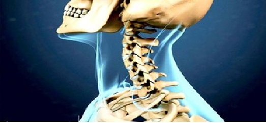 دیسک های بین مهره ای گردنی