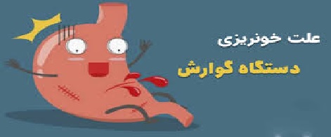 خونریزی دستگاه گوارش