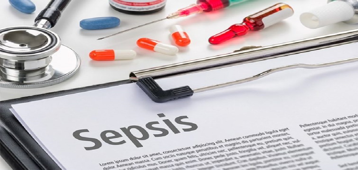 سپسیس