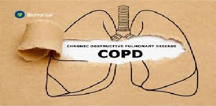 بیماریهای انسدادی ریه