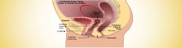 نیاز های آموزشی بیمار پس از جراحی سیستوسل رکتوسل