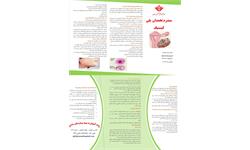 پمفلت سندرم تخمدان پلی کیستیک