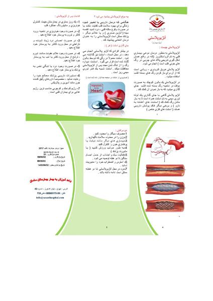 انژیوپلاستی