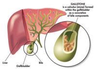 gall1